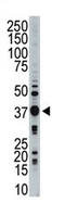 Edpk antibody, AP13931PU-N, Origene, Western Blot image 