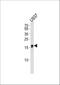 IQ Motif Containing F6 antibody, A19644, Boster Biological Technology, Western Blot image 