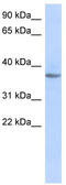 Olfactory Receptor Family 10 Subfamily X Member 1 (Gene/Pseudogene) antibody, TA344311, Origene, Western Blot image 