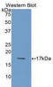 Interleukin 36 Receptor Antagonist antibody, LS-C294787, Lifespan Biosciences, Western Blot image 