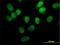 Serine/Threonine Kinase 33 antibody, H00065975-M02, Novus Biologicals, Immunofluorescence image 