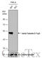 Tubulin Beta 3 Class III antibody, GTX631831, GeneTex, Western Blot image 