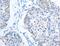 5-aminolevulinate synthase, nonspecific, mitochondrial antibody, MBS2518055, MyBioSource, Immunohistochemistry paraffin image 