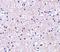 Immediate Early Response 3 antibody, A04014, Boster Biological Technology, Immunohistochemistry paraffin image 