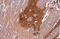 Protein Tyrosine Kinase 2 Beta antibody, GTX634162, GeneTex, Immunohistochemistry paraffin image 