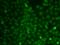 Cbl Proto-Oncogene C antibody, GTX33067, GeneTex, Immunofluorescence image 