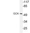 Glucokinase antibody, LS-C177249, Lifespan Biosciences, Western Blot image 