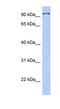 Transient Receptor Potential Cation Channel Subfamily C Member 4 Associated Protein antibody, NBP1-58911, Novus Biologicals, Western Blot image 