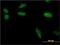 Small Ubiquitin Like Modifier 1 antibody, H00007341-M03, Novus Biologicals, Immunocytochemistry image 
