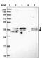 SGT1 Homolog, MIS12 Kinetochore Complex Assembly Cochaperone antibody, NBP2-38518, Novus Biologicals, Western Blot image 