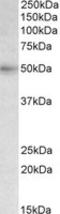 Solute Carrier Family 46 Member 1 antibody, LS-C139787, Lifespan Biosciences, Western Blot image 