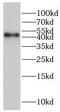 Inositol-Tetrakisphosphate 1-Kinase antibody, FNab04421, FineTest, Western Blot image 