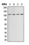 Actinin Alpha 1 antibody, orb224153, Biorbyt, Western Blot image 