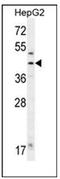 Fumarylacetoacetate Hydrolase antibody, AP51509PU-N, Origene, Western Blot image 