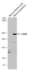 Leucine Rich Repeat Kinase 2 antibody, GTX133135, GeneTex, Western Blot image 
