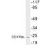 Immunoglobulin Lambda Like Polypeptide 1 antibody, LS-C199790, Lifespan Biosciences, Western Blot image 