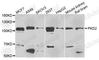 Polycystin 2, Transient Receptor Potential Cation Channel antibody, A3625, ABclonal Technology, Western Blot image 