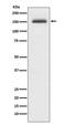 CD49D antibody, M00468, Boster Biological Technology, Western Blot image 