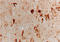 Heme Oxygenase 1 antibody, GTX30748, GeneTex, Immunohistochemistry paraffin image 