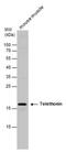 Titin-Cap antibody, PA5-78255, Invitrogen Antibodies, Western Blot image 