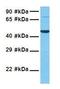 Probable protein-cysteine N-palmitoyltransferase porcupine antibody, GTX46000, GeneTex, Western Blot image 