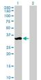 Zinc Finger Matrin-Type 3 antibody, H00064393-B01P, Novus Biologicals, Western Blot image 