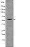 Transforming Growth Factor Beta Receptor 1 antibody, PA5-64809, Invitrogen Antibodies, Western Blot image 