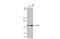 Ubiquitin Specific Peptidase 7 antibody, GTX631108, GeneTex, Western Blot image 