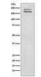 Ret Proto-Oncogene antibody, M00293, Boster Biological Technology, Western Blot image 