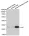 Carbonic Anhydrase 3 antibody, abx001124, Abbexa, Western Blot image 