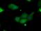 Pim-2 Proto-Oncogene, Serine/Threonine Kinase antibody, GTX83892, GeneTex, Immunofluorescence image 
