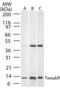 Tumor necrosis factor receptor superfamily member 12A antibody, PA1-29818, Invitrogen Antibodies, Western Blot image 