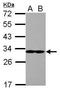 Eukaryotic Translation Initiation Factor 2B Subunit Alpha antibody, GTX109525, GeneTex, Western Blot image 