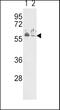 Natriuretic Peptide Receptor 3 antibody, PA5-15394, Invitrogen Antibodies, Western Blot image 