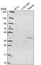 MYCL Proto-Oncogene, BHLH Transcription Factor antibody, PA5-66558, Invitrogen Antibodies, Western Blot image 