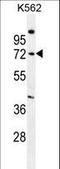 Sphingomyelin Phosphodiesterase 1 antibody, LS-B10421, Lifespan Biosciences, Western Blot image 