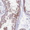 Integrin Subunit Alpha E antibody, HPA036313, Atlas Antibodies, Immunohistochemistry paraffin image 