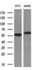 Ribosomal Protein S6 Kinase B1 antibody, M01475-2, Boster Biological Technology, Western Blot image 