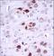 Megakaryocyte-Associated Tyrosine Kinase antibody, LS-C164482, Lifespan Biosciences, Immunohistochemistry frozen image 