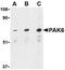 Serine/threonine-protein kinase PAK 6 antibody, NBP1-76632, Novus Biologicals, Western Blot image 