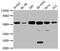 Cytochrome P450 Family 21 Subfamily A Member 2 antibody, CSB-PA006400LA01HU, Cusabio, Western Blot image 