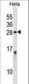 Protein Phosphatase 1 Regulatory Inhibitor Subunit 2 antibody, LS-C162081, Lifespan Biosciences, Western Blot image 