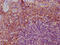 Interleukin 3 antibody, LS-C318549, Lifespan Biosciences, Immunohistochemistry paraffin image 
