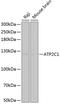 ATPase Secretory Pathway Ca2+ Transporting 1 antibody, GTX64837, GeneTex, Western Blot image 