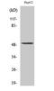 Phenylalanine Hydroxylase antibody, STJ94933, St John