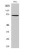 Zinc Finger Protein 225 antibody, A12573-1, Boster Biological Technology, Western Blot image 