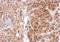 Steroidogenic Acute Regulatory Protein antibody, GTX105716, GeneTex, Immunohistochemistry paraffin image 