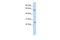 Solute Carrier Family 18 Member A1 antibody, PA5-41092, Invitrogen Antibodies, Western Blot image 