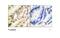 Serum/Glucocorticoid Regulated Kinase 1 antibody, ab55281, Abcam, Immunohistochemistry paraffin image 