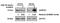 SAM And HD Domain Containing Deoxynucleoside Triphosphate Triphosphohydrolase 1 antibody, A00592-1, Boster Biological Technology, Western Blot image 